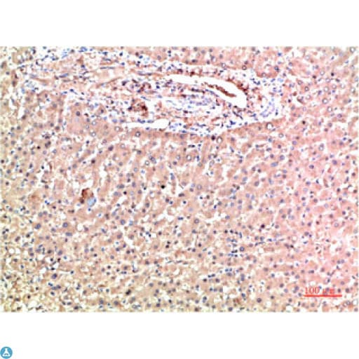 Monoclonal Mouse anti-Human TTR / Transthyretin Antibody (WB)
