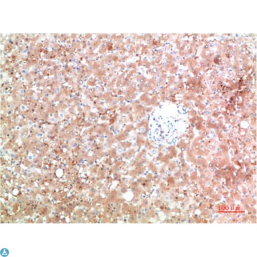 TTR / Transthyretin Antibody