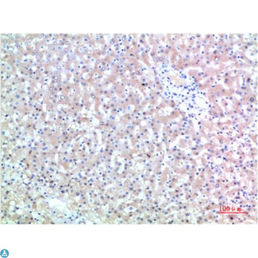 Monoclonal Mouse anti-Human TTR / Transthyretin Antibody (WB)