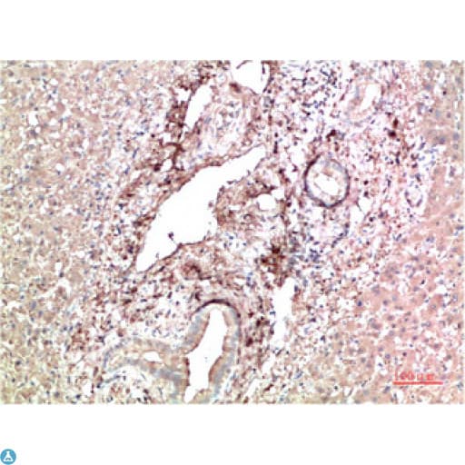 TTR / Transthyretin Antibody
