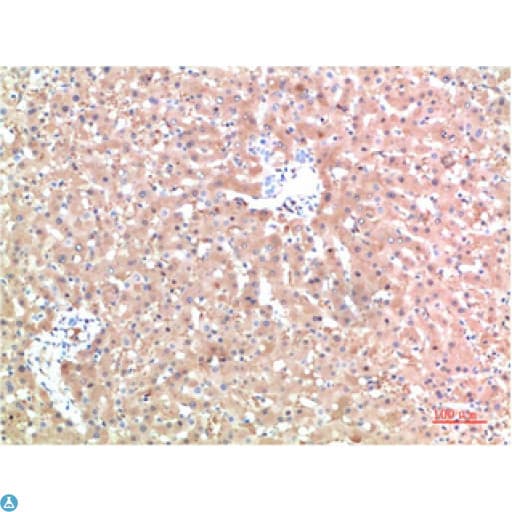 TTR / Transthyretin Antibody