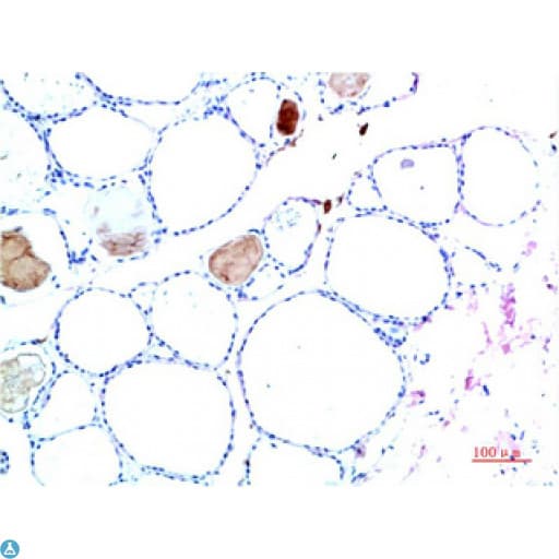 Monoclonal Mouse anti-Human TTR / Transthyretin Antibody (WB)