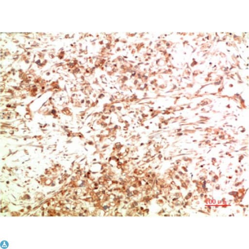 Monoclonal Mouse anti-Human APG5 / ATG5 Antibody (WB)