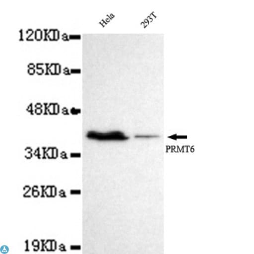 Monoclonal Mouse anti-Human PRMT6 Antibody (WB)