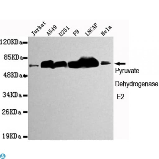 Anti-Pyruvate Dehydrogenase E2 antibody Antibody