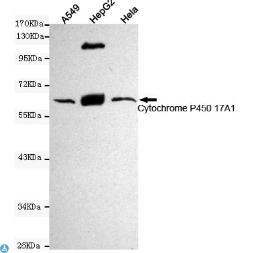 Monoclonal Mouse anti-Human CYP17 / CYP17A1 Antibody (WB)