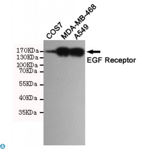 Monoclonal Mouse anti-Human EGFR Antibody (WB)