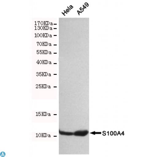 Monoclonal Mouse anti-Human S100A4 / FSP1 Antibody (WB)