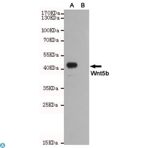 Monoclonal Mouse anti-Human WNT5B Antibody (WB)