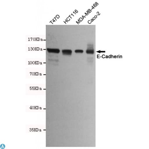 CDH1 / E Cadherin Antibody