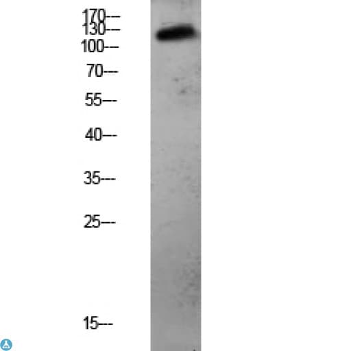 Polyclonal Rabbit anti-Human CDH3 / P-Cadherin Antibody (WB)