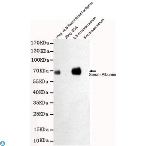 ALB / Serum Albumin Antibody