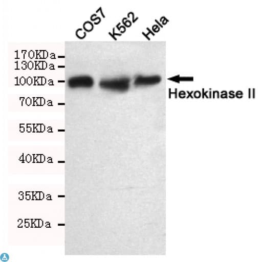 Monoclonal Mouse anti-Human HK2 / Hexokinase 2 Antibody (WB)