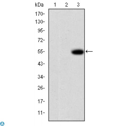 Monoclonal Mouse anti-Human MMP9 / Gelatinase B Antibody (IHC, IF, WB)