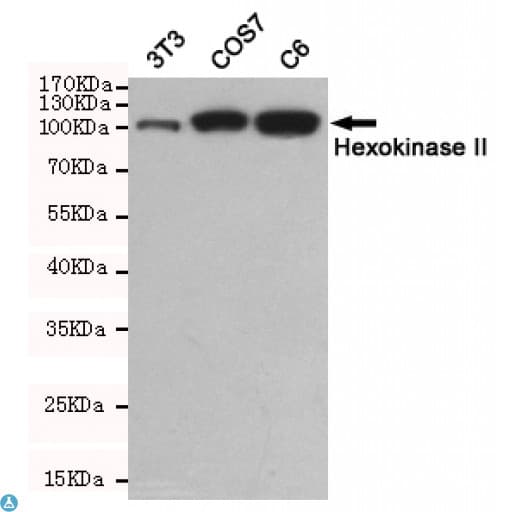 Monoclonal Mouse anti-Human HK2 / Hexokinase 2 Antibody (WB)
