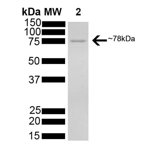 Human HSPA5 / GRP78 / BiP Protein (Recombinant His)