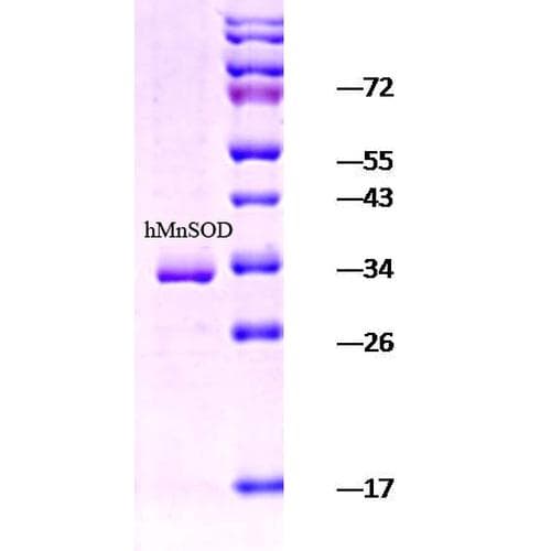 Human SOD2 / Mn SOD Protein (Recombinant His)