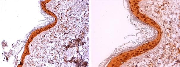 Polyclonal Rabbit anti-Human LGALS7 / Galectin 7 Antibody (IHC, WB)