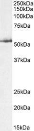 glk / Glucokinase Antibody