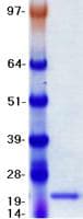 Human TNF Alpha Protein (Recombinant His-DDK (Flag), N-terminus)