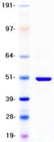 Human CYP2D6 Protein (Recombinant DDK,C-terminus)