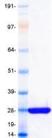 Human KRAS Protein (Recombinant Myc-DDK (Flag), C-terminus)
