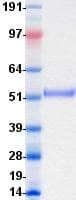 Human ROR2 Protein (Recombinant DDK (Flag)-His, C-terminus)