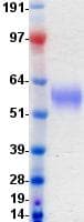 Human DDR2 Protein (Recombinant DDK (Flag)-His, C-terminus)