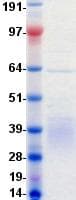 Human RYK Protein (Recombinant DDK (Flag)-His, C-terminus)