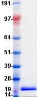 Human ANGPTL4 Protein (Recombinant DDK (Flag)-His, C-terminus)