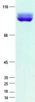 Human TPO / Thyroid Peroxidase Protein (Recombinant His,C-terminus)
