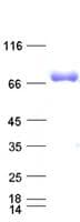 Human HSPA1A Protein (Recombinant His,C-terminus)