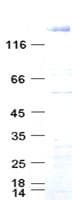 Human EGFR Protein (Recombinant DDK,C-terminus)