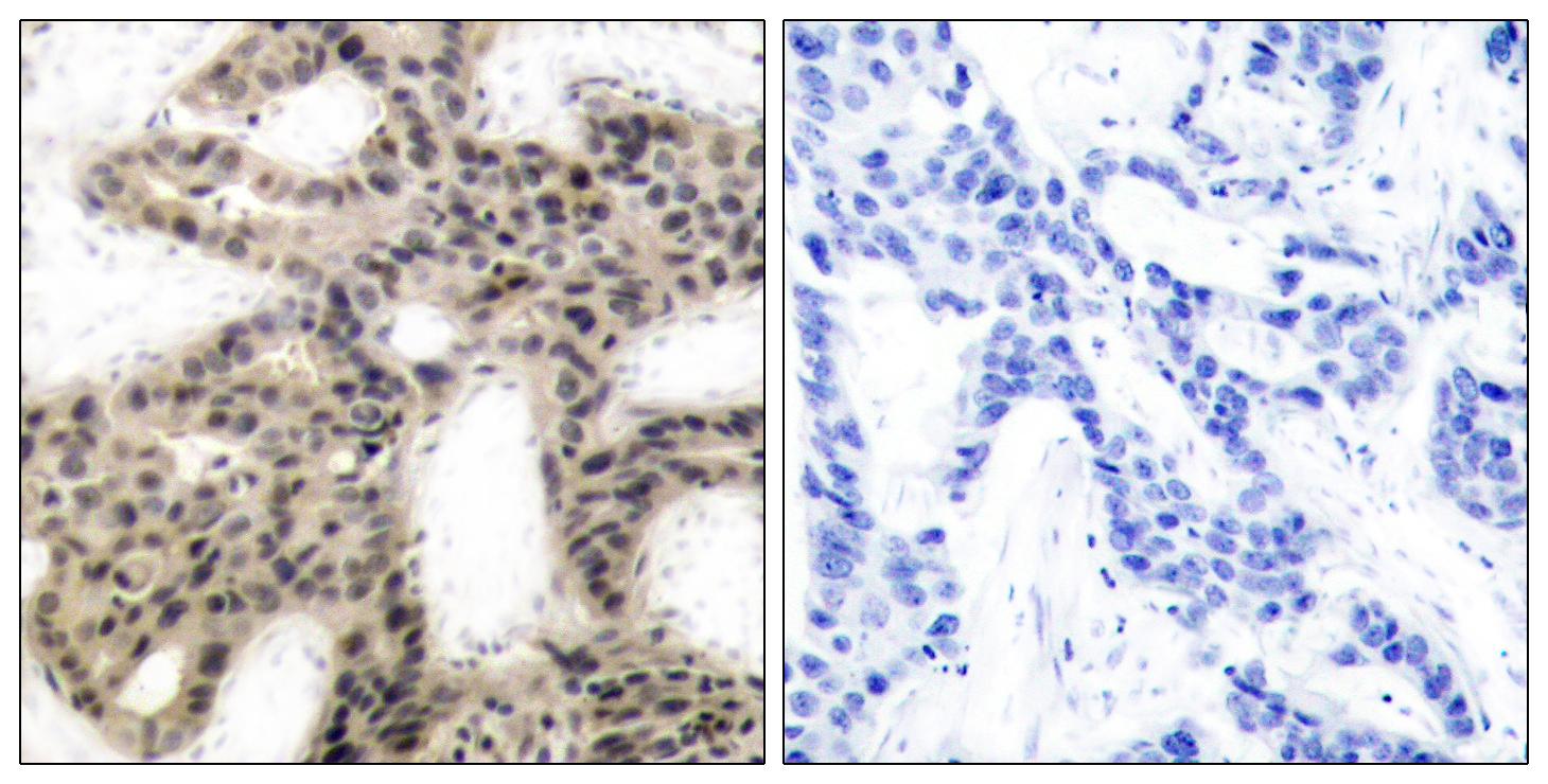 Polyclonal Rabbit anti-Human EIF4EBP1 / 4EBP1 Antibody (phospho-Thr45, IHC, WB)