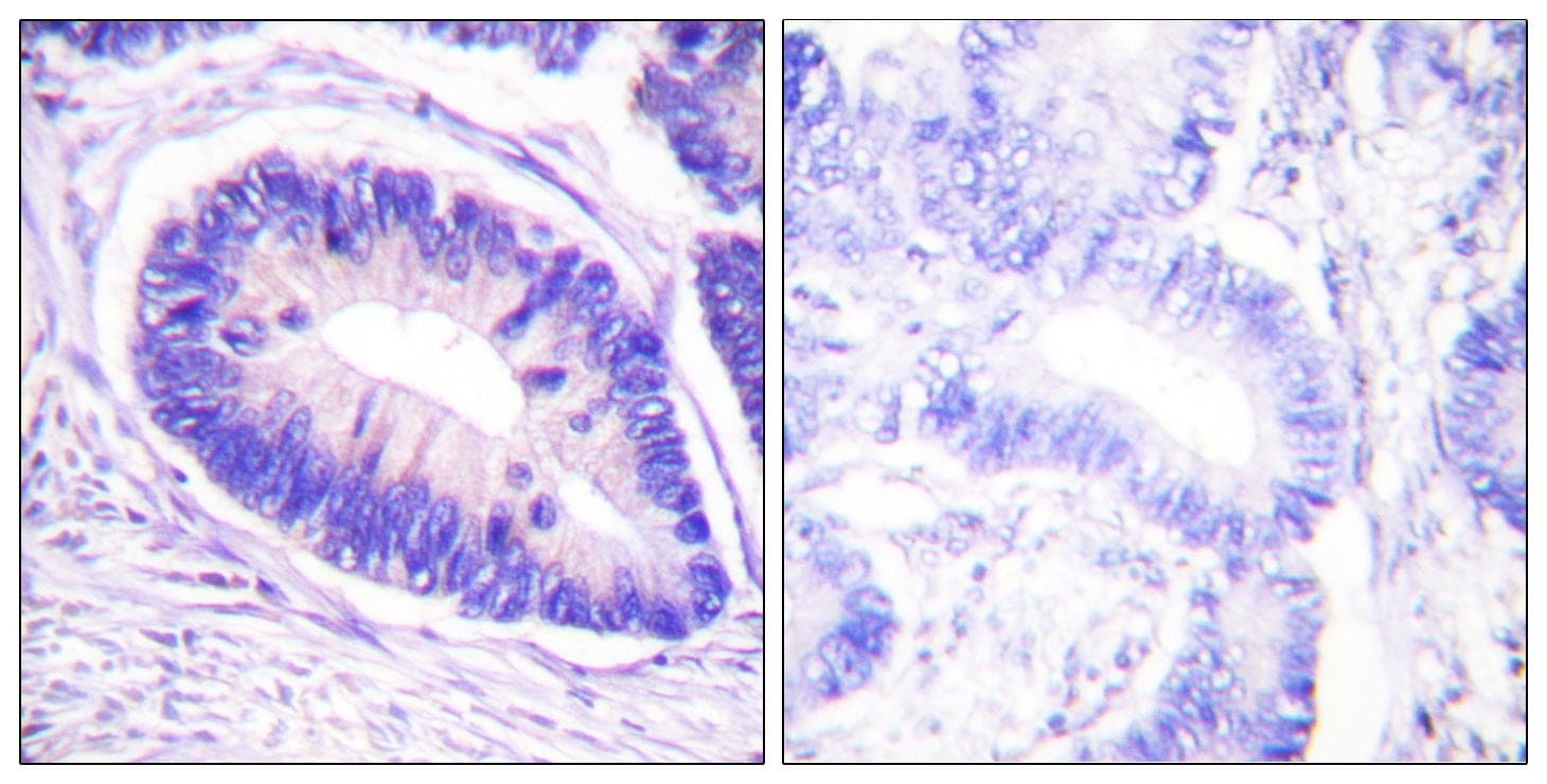Polyclonal Rabbit anti-Human PPP1R12A / MYPT1 Antibody (phospho-Thr853, IHC, WB)