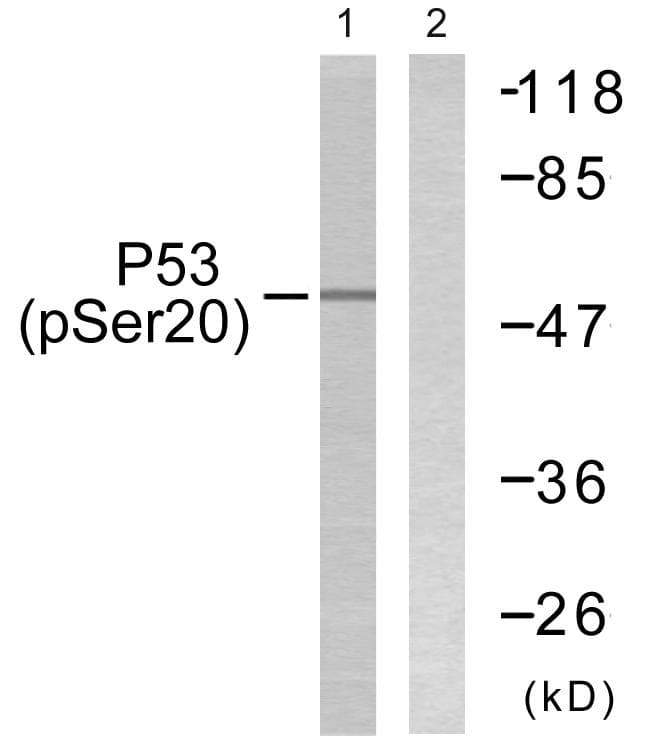 TP53 / p53 Antibody (phospho-Ser20)