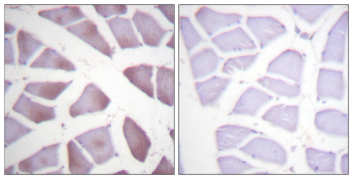 Polyclonal Rabbit anti-Human PEA15 / PEA-15 Antibody (p116, IHC, IF, WB)