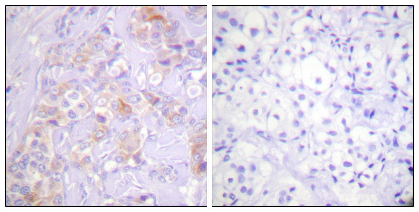 ZAP70 Antibody (Ab-315)