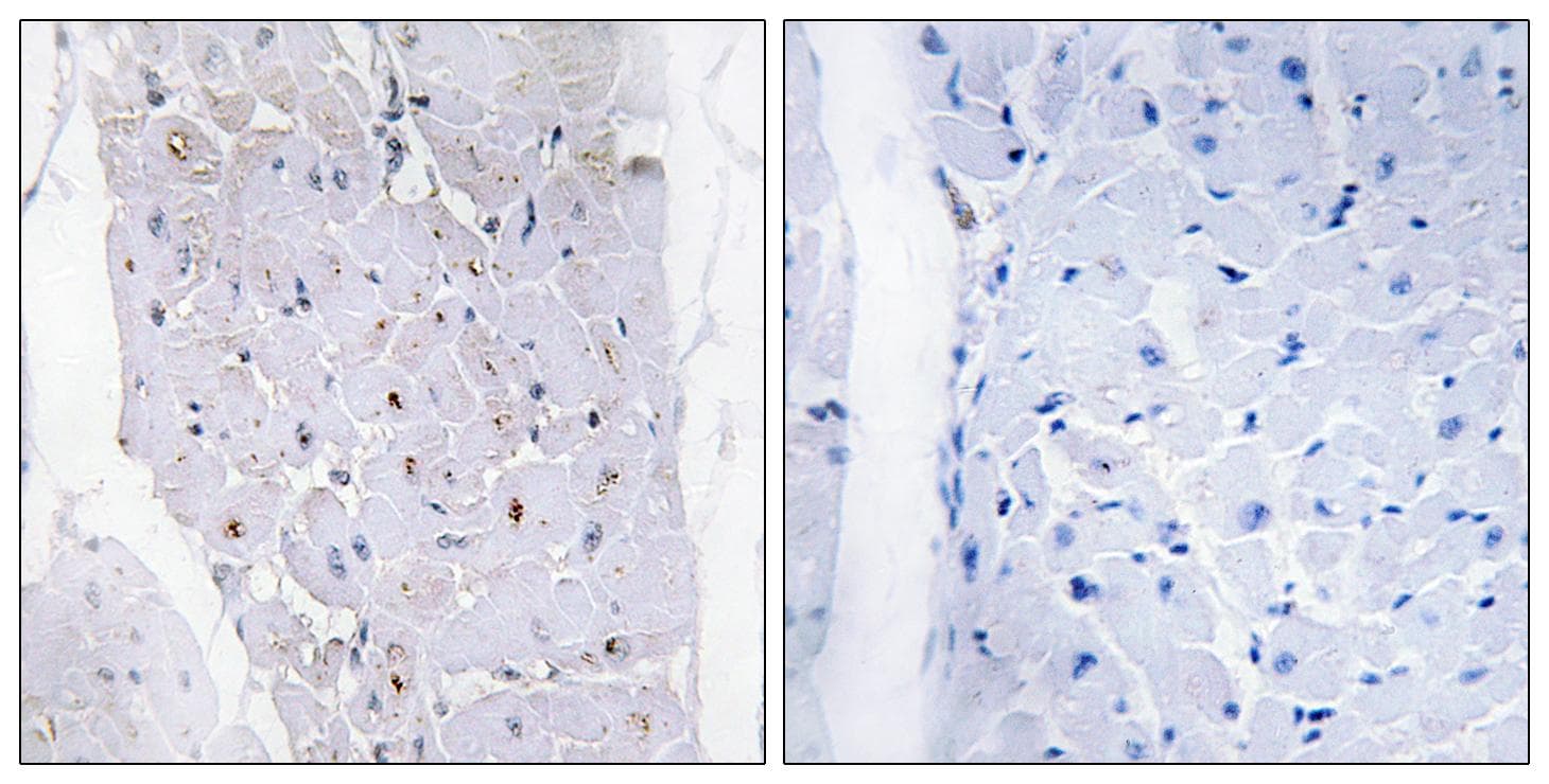 Polyclonal Rabbit anti-Human CHEK1 / CHK1 Antibody (Ab-296, IHC)