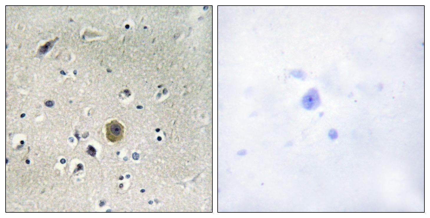 Polyclonal Rabbit anti-Human MAP2K1 / MKK1 / MEK1 Antibody (p298, IHC, WB)