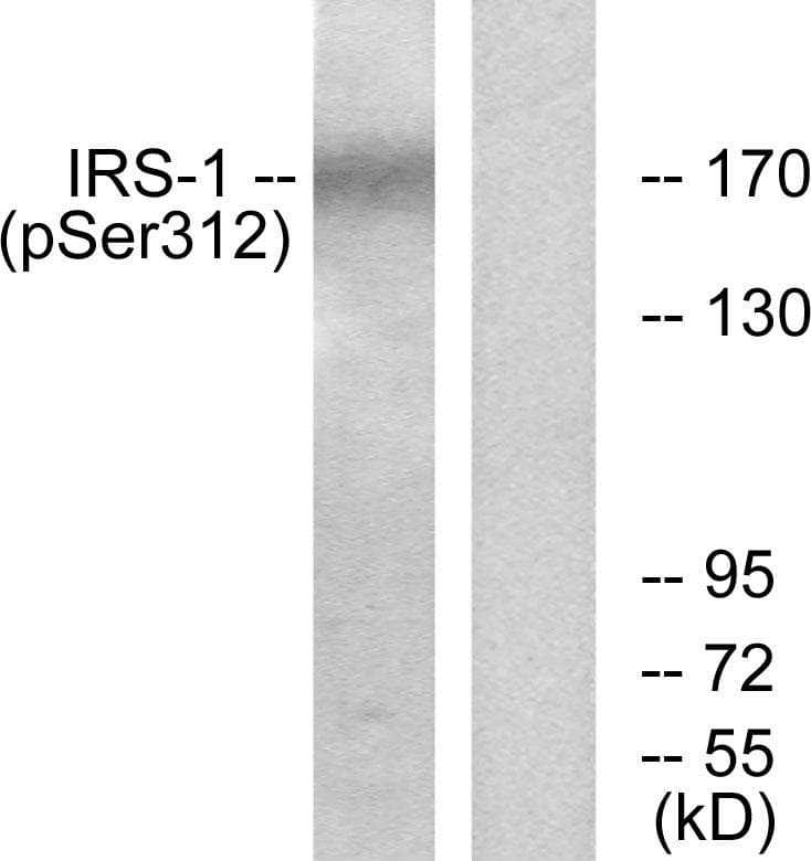Polyclonal Rabbit anti-Human IRS1 Antibody (phospho-Ser312, IF, WB)