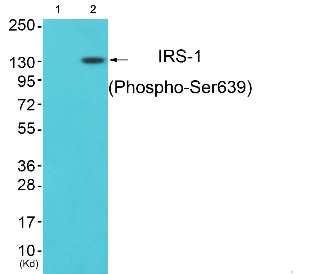 Polyclonal Rabbit anti-Human IRS1 Antibody (phospho-Ser639, IHC, WB)