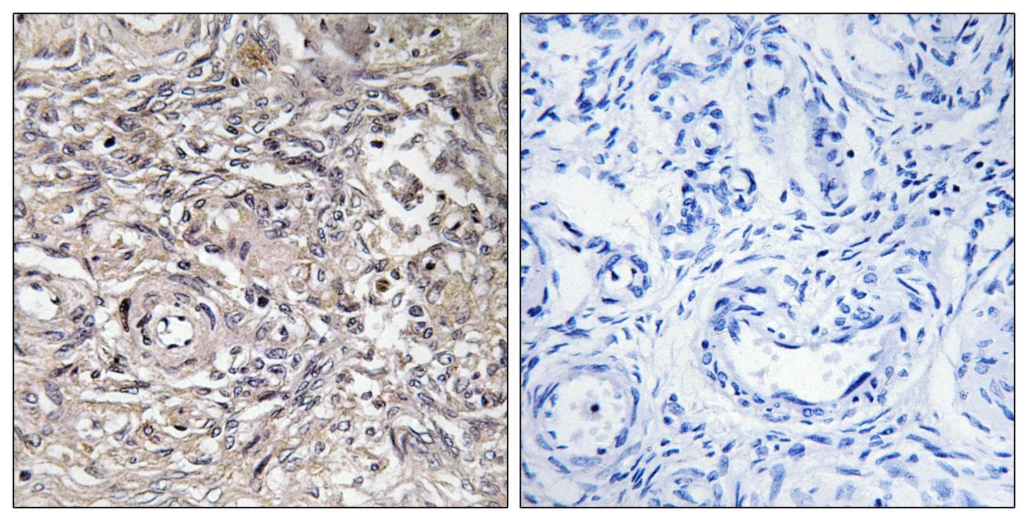 Polyclonal Rabbit anti-Human CLDN6 / Claudin 6 Antibody (IHC, IF, WB)