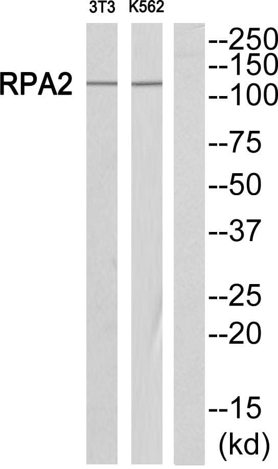 Polyclonal Rabbit anti-Human RPA2 / RFA2 / RPA34 Antibody (WB)