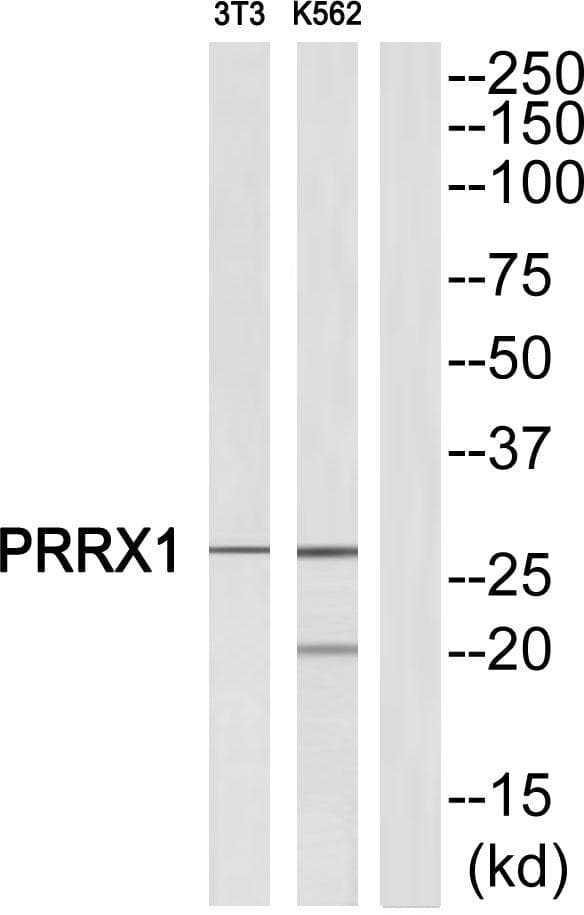 Polyclonal Rabbit anti-Human PRX-1 / PRRX1 Antibody (WB)