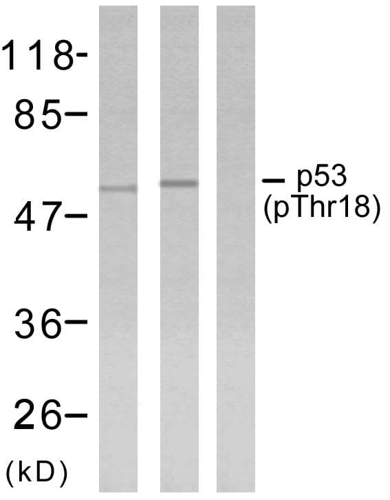 Polyclonal Rabbit anti-Human TP53 / p53 Antibody (phospho-Thr18, WB)