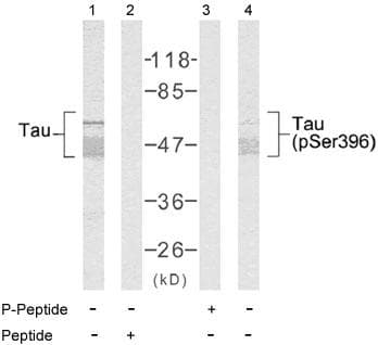 Polyclonal Rabbit anti-Human MAPT / Tau Antibody (phospho-Ser396, WB)