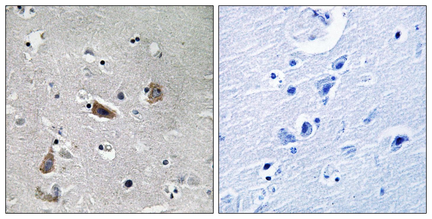Polyclonal Rabbit anti-Human DCX / Doublecortin Antibody (phospho-Ser376, IHC)
