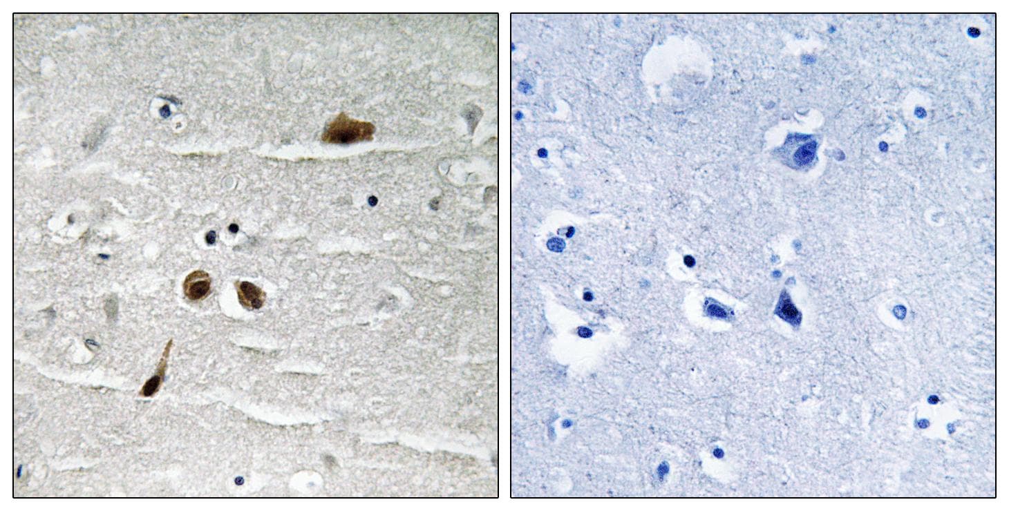 Polyclonal Rabbit anti-Human MDC1 Antibody (phospho-Ser513, IHC)