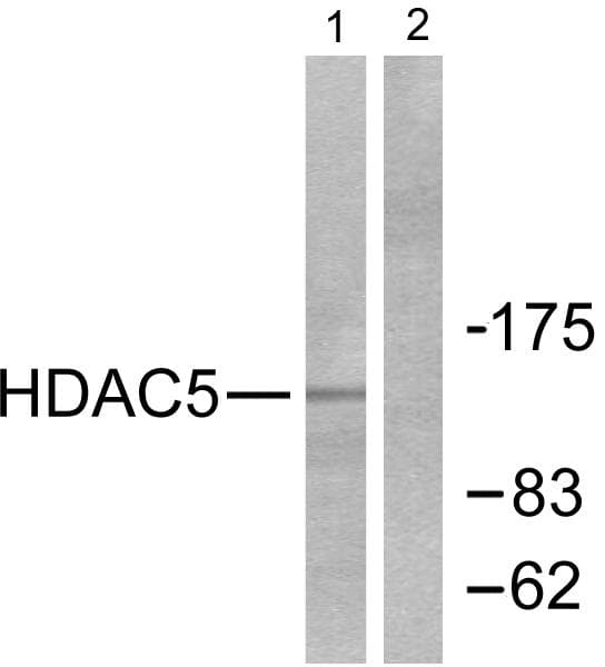 Polyclonal Rabbit anti-Human HDAC5 Antibody (p259, IHC, WB)
